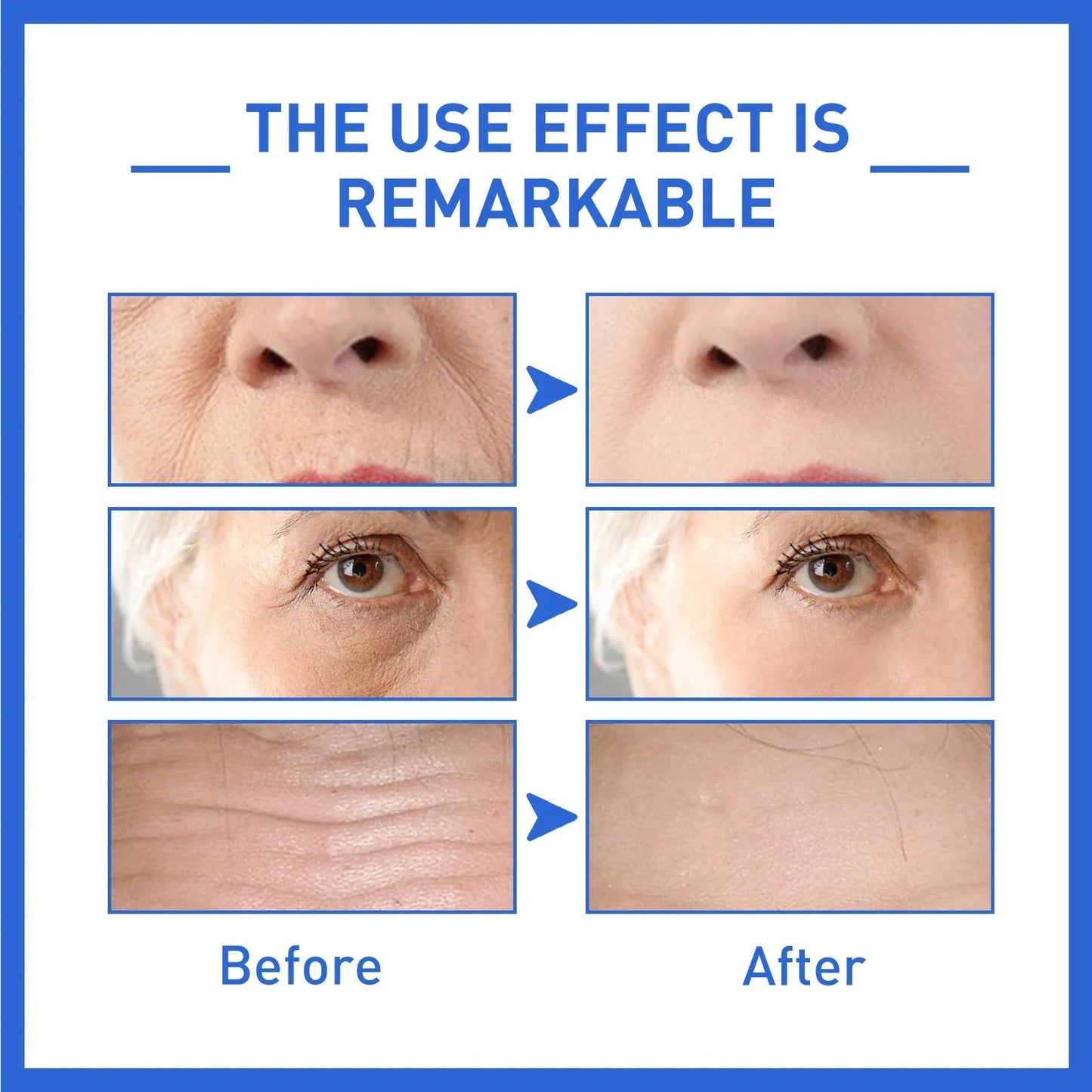 Ceraquie™ -Anti-Aging Collagen